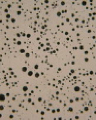 Fotos Microscópicas De Ferro Fundido Nodular