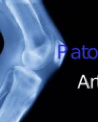 Patologia - Artrite Slide